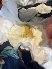 2 week old mucus poop
