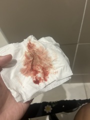 Random bleed / brown smudge...what's  happening