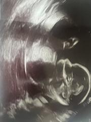 Boy or girl