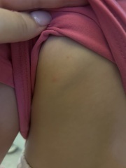 Anyone have any clue what these spots are?