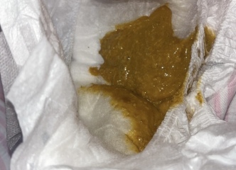 ? CMPA poo or normal