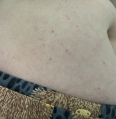 What is this rash :(