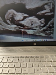 Gender of scan images