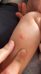 What could these spots be?