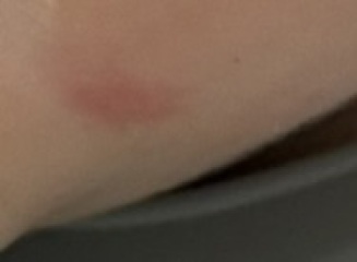 Random red patches