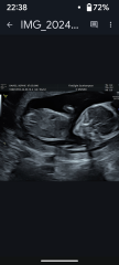 Gender of scan images