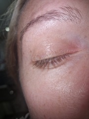 Start of conjunctivitis? Stye??
