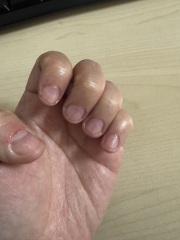 To Ask How To Stop Biting Nails