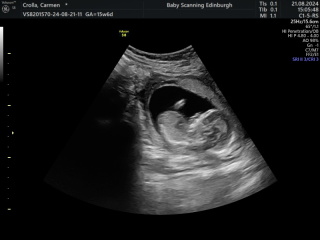 16 week gender reveal images