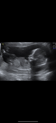 Due March 2025 thread 2