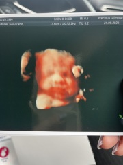 4D scan guess boy or girl?