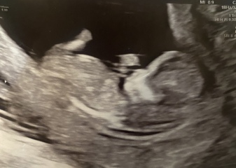 Boy or girl