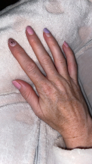 Guess the age by my hands!