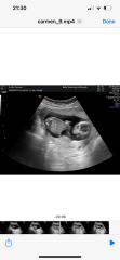 16 week gender reveal images