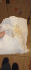 Different discharge advice