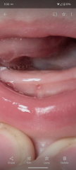 Teeth?