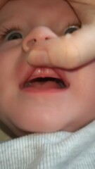 Baby's gums swollen for weeks...but no teeth!