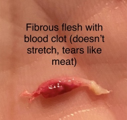 Any idea what this could be...GROSS PIC INCLUDED