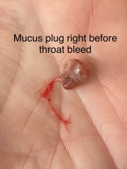 Any idea what this could be...GROSS PIC INCLUDED