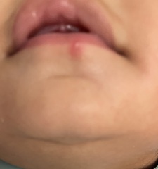 Is this a cold sore on my baby?