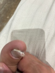 **warning gross feet pic **