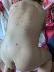 What's this rash - red spots?