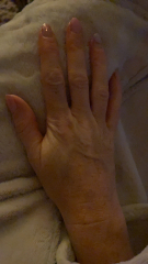 Guess the age by my hands!