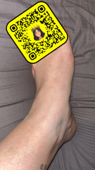 Rash and itch