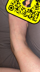 Rash and itch