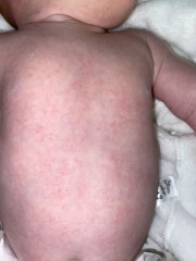 6 Week old- Red raised spots