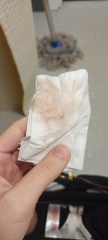 Different discharge advice