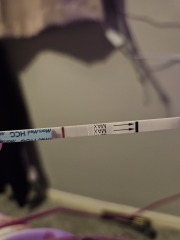 Do I have line eyes?