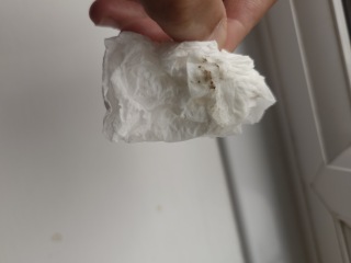 Is this Bacterial vaginosis discharge?