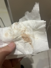 Random bleed / brown smudge...what's  happening