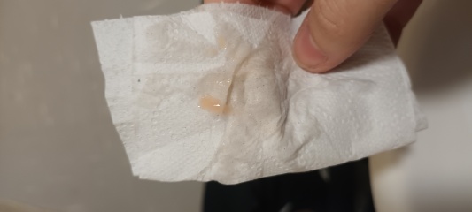 Different discharge advice