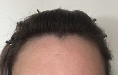 To cut the front piece of my hair off? With pics