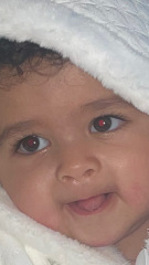 White eye photo flash baby