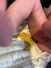 2 week old mucus poop