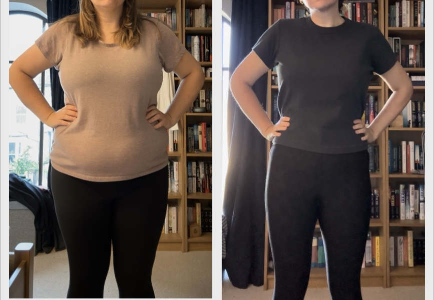 Mounjaro - Before & after results