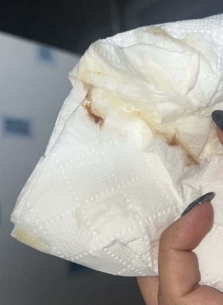 Is this my mucus plug? TMI