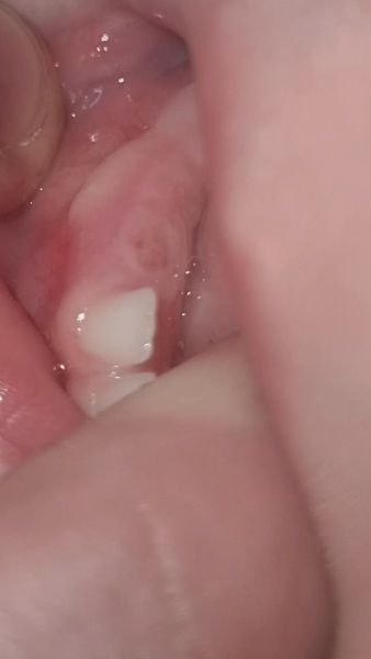 Teething baby - help