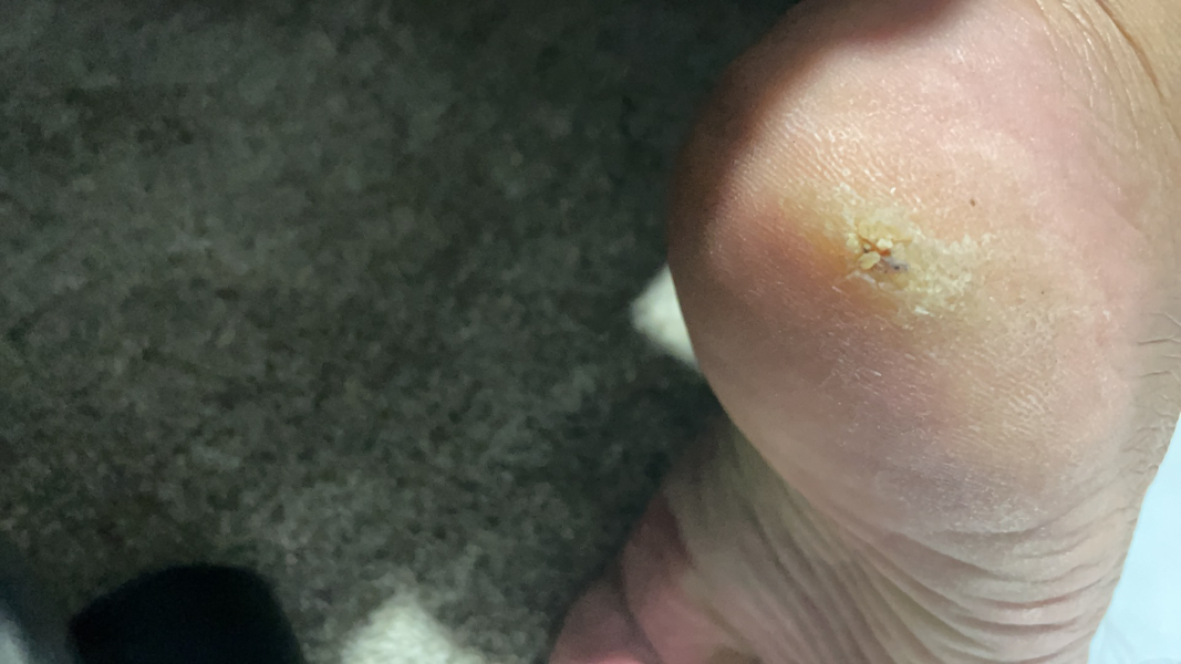 Help with my foot please