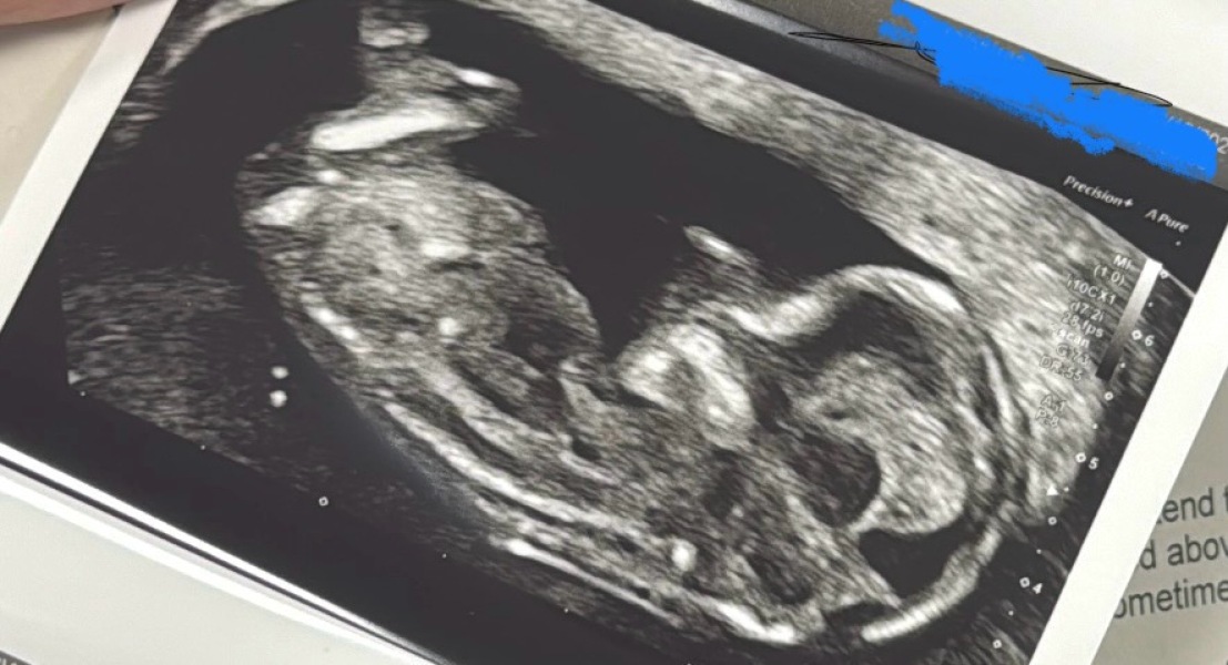 Gender guesses please!