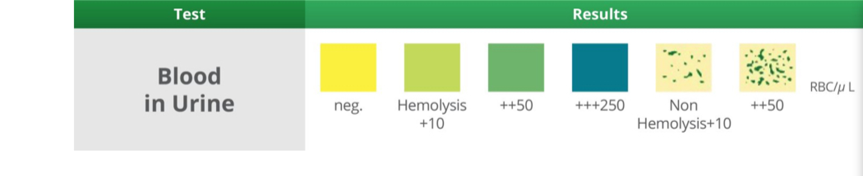 Help with urine dip test results