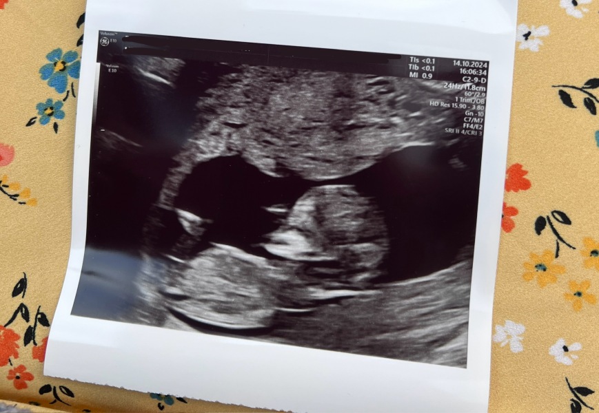 Due April 2025 ✨