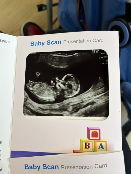 Boy or girl?