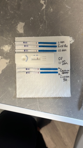 Positive pregnancy test followed by 2 negative
