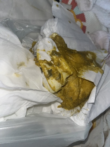 **warning - photo*** please help, is this blood or mucous in baby poo?