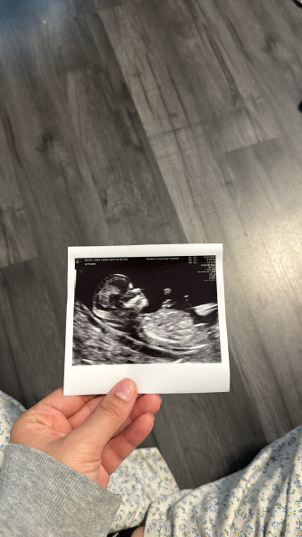 12 week scan pic, boy or girl?