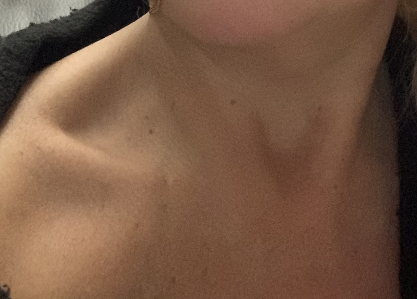 Mounjaro August Starters 6